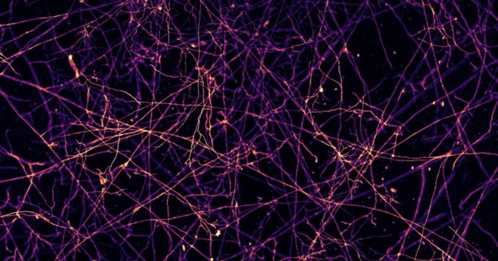 black and purple fungal network