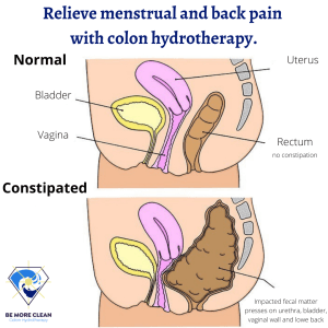 colon hydrotherapy benefits diagram